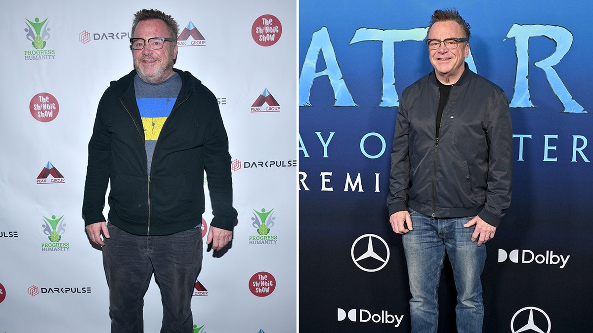 tom arnold weight loss