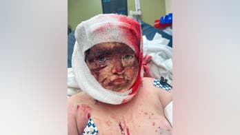 Georgia boy, 11, pulled from bike and attacked by 'loose' pit bulls loses part of ear, most of his scalp