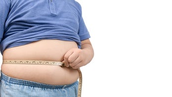 American Academy of Pediatrics shredded for pushing surgery to fight childhood obesity: 'Questionable at best'