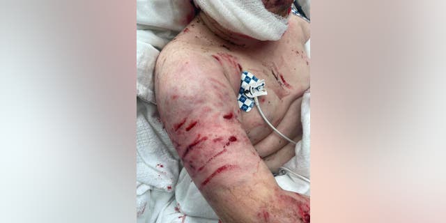Scott B.'s attack came less than two weeks after 11-year-old Justin Gilstrap (pictured above), another Georgia resident, was nearly killed by three pit bulls.