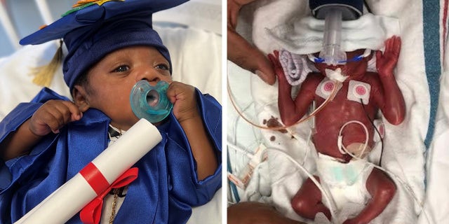 Amandi on the left, wearing a hat and gown, with his "graduation" From the NICU where he stayed for 155 days after birth on January 10, 2022. On the right is Amandi after giving birth prematurely at her 23 weeks.