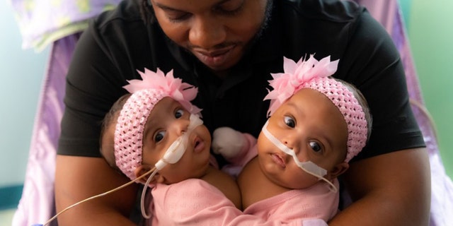 Las gemelas unidas AmieLynn Rose y JamieLynn Rae Finley fueron separadas quirúrgicamente el lunes 23 de enero de 2023 en el Cook Children's Medical Center en Fort Worth, Texas.