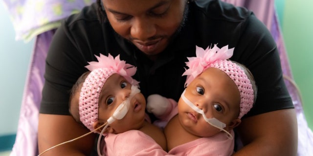 Las gemelas unidas AmieLynn Rose y JamieLynn Rae Finley fueron separadas quirúrgicamente el lunes 23 de enero de 2023 en el Cook Children's Medical Center en Fort Worth, Texas.