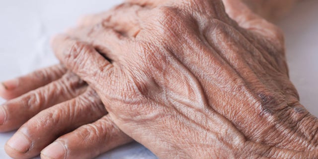 World’s Oldest Person Dies 3 The oldest person in the world is now believed to be Maria Branyas Morena of Spain.