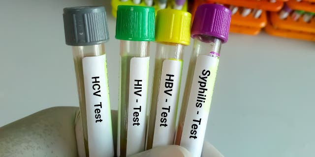 Scientist holds blood samples tube for sexually transmitted diseases, including syphilis, HIV, HBV and HCV.