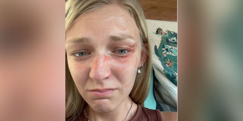 Gabby Petito update: Newly released high-res photo shows injuries from Utah domestic call - Vimarsana News