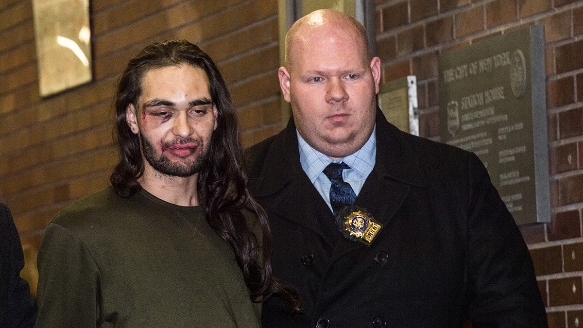 Suspect Jose Gonzalez shows beaten face in perp walk