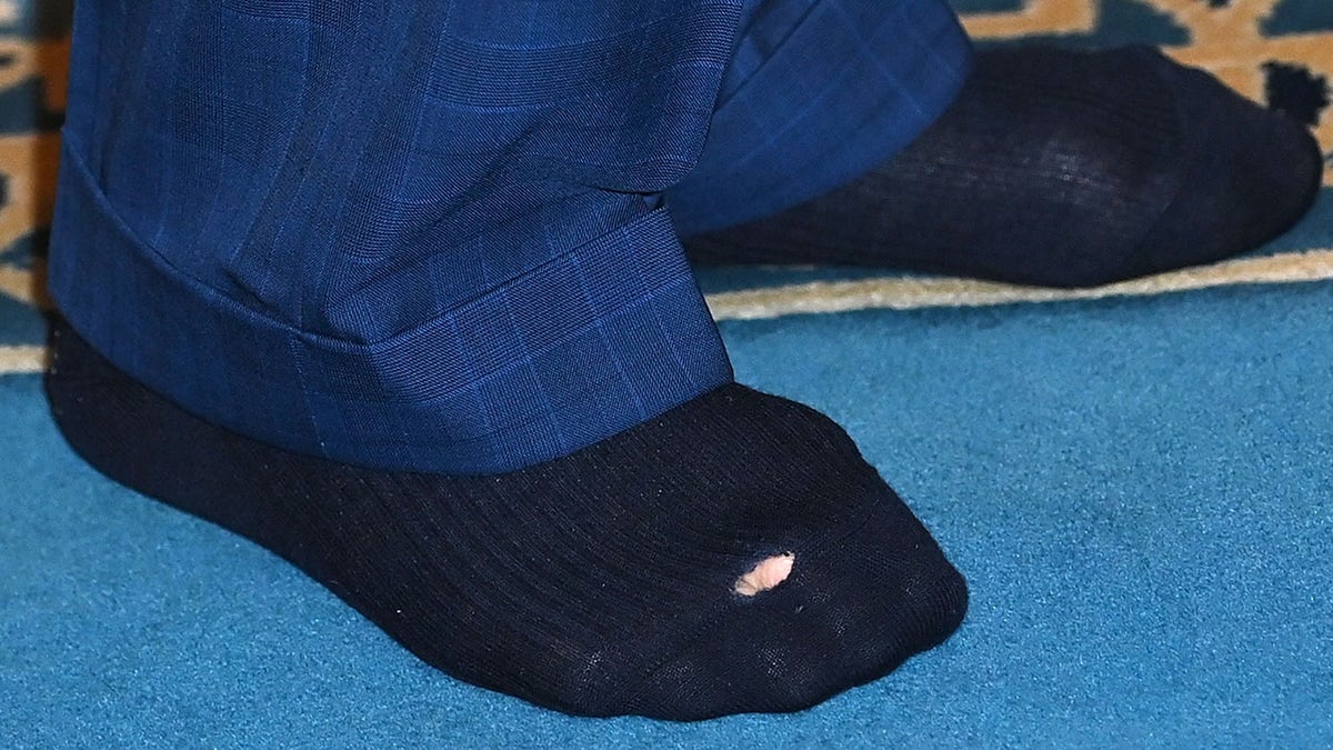 King Charles with a hole in his sock