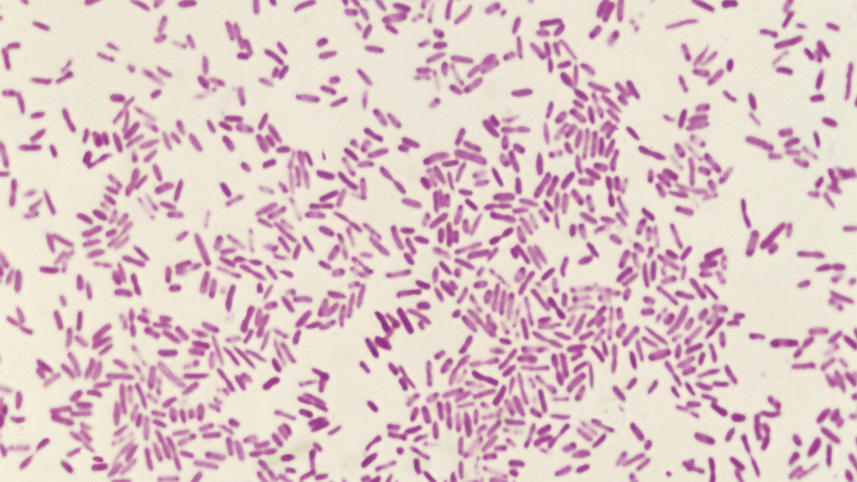 shigellosis