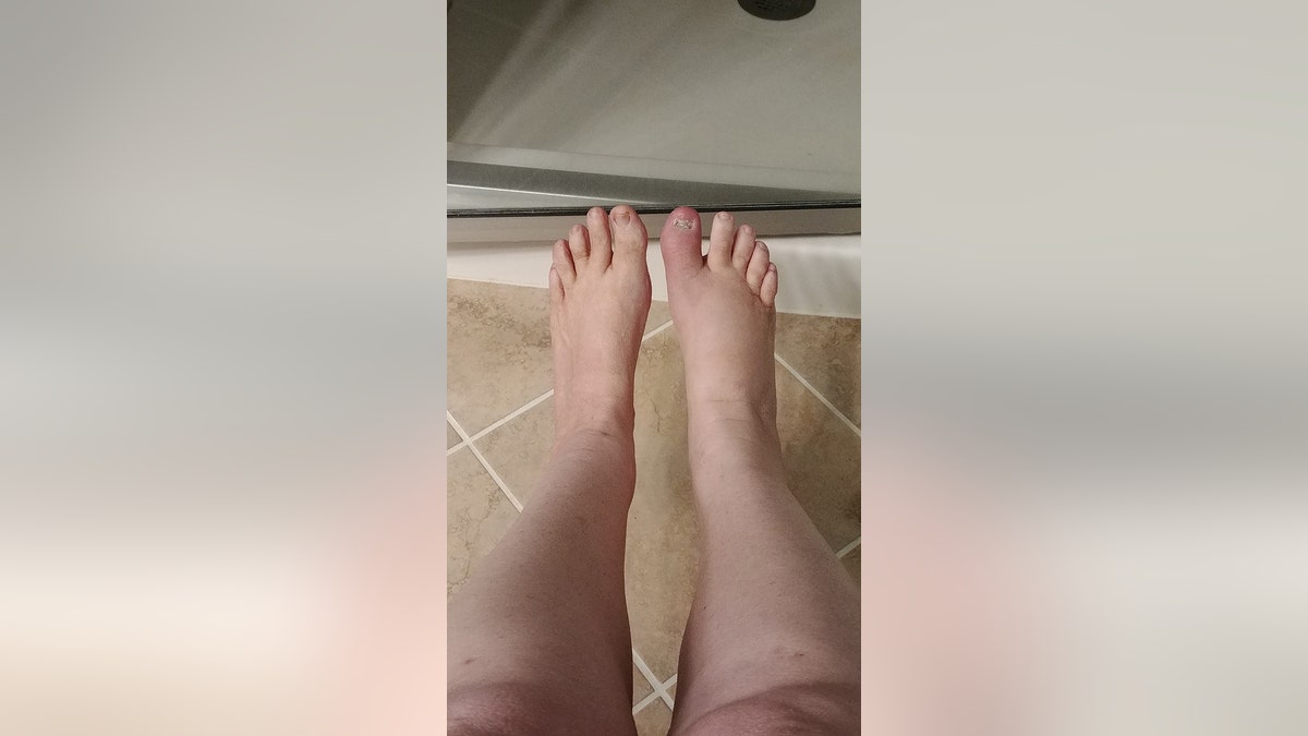 anita house bad toe