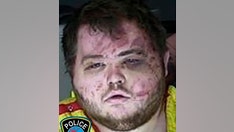 Colorado Springs Club Q 'nonbinary' shooting suspect ran neo-Nazi site, used gay slurs online, police testify