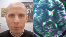 Indiana priest says he's cured of brain tumor after trip to Lourdes: 'Thanks be to God'