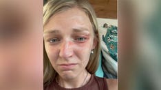 Gabby Petito update: Newly released high-res photo shows injuries from Utah domestic call