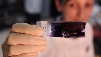 Australia worried 'prolific' sperm donors could lead to 'accidental incest'