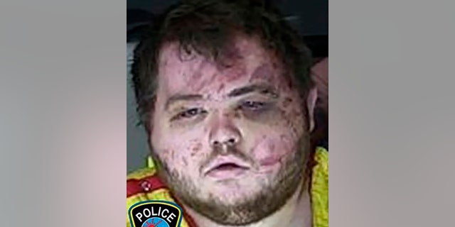 Anderson Lee Aldrich, seen beaten in his mugshot after the Club Q shooting, reportedly shook during a court hearing Wednesday that will decide whether there is enough evidence for a trial. 