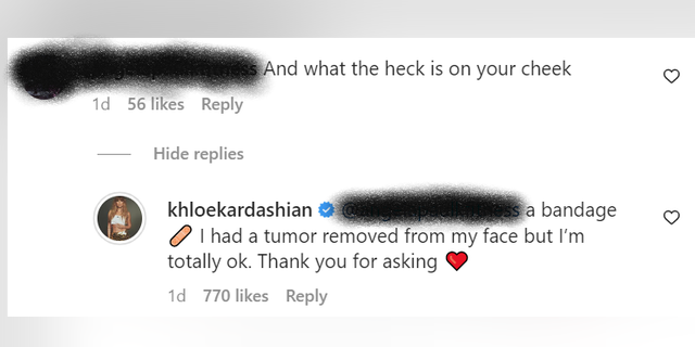 Khloé Kardashian took to her Instagram comments to clear the air about the bandage on her face.