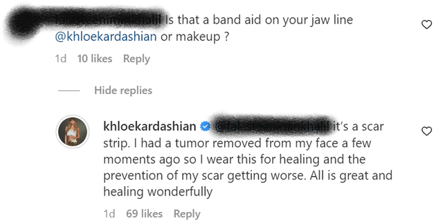 Khloé Kardashian told one Instagram user she's "healing wonderfully" after having a tumor removed.