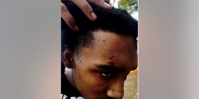 Monterrious Harris' injuries after an alleged attack by the ex-Memphis police officers who beat Tyre Nichols to death, according to to federal lawsuit.