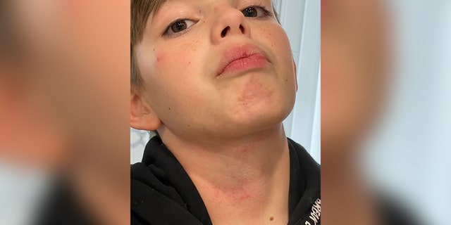 Virginia mother Taylor Brock says her son was bullied and choked on a Fairfax County School District bus.