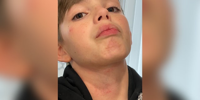 Virginia mother Taylor Brock says her son was bullied and choked on a Fairfax County School District bus.