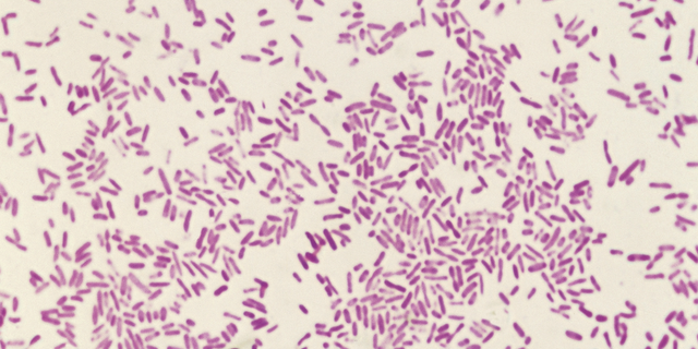Shigella dysenteriae, germs which causes bacillary dysentery aliases shigellosis, seen nether a microscope.