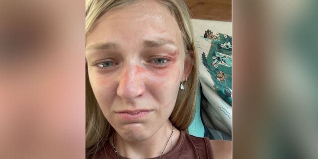 Gabby Petito with blood on her face in an Aug. 12, 2021 traffic stop in Moab, Utah.