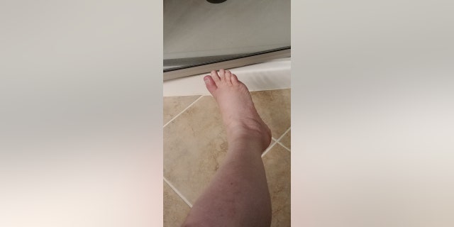 House saw several doctors before the bacterial infection in her toe grew worse — as did the pain, she said.