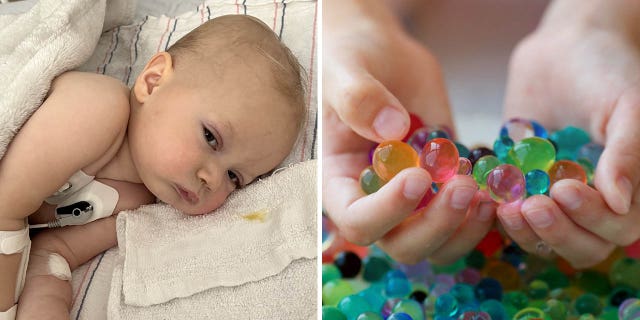 Baby Harper is now home from the hospital and is slowly recovering, her mother Whitney Reese said. The little girl is shown her eat left, with a child holding water beads shown on right.