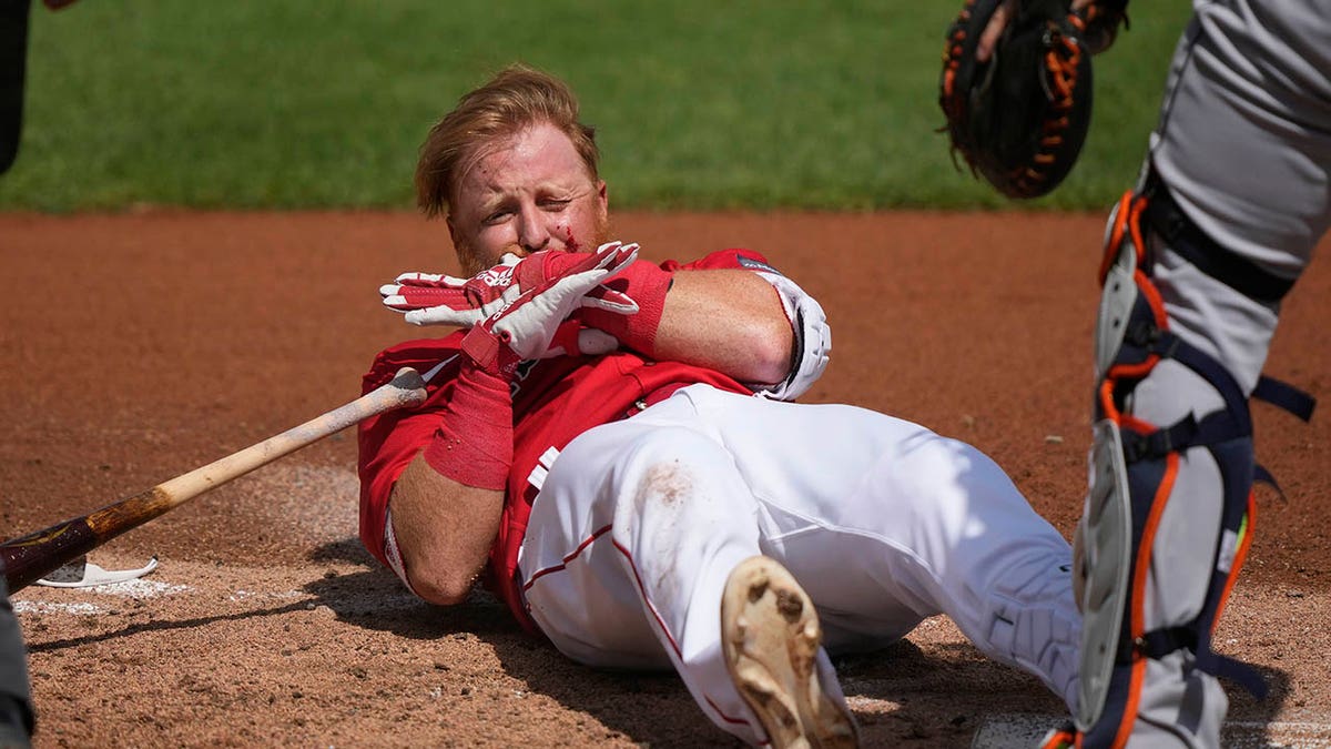 Red Sox's Justin Turner 'feeling very fortunate' after pitch to face led to  hospitalization and 16 stitches