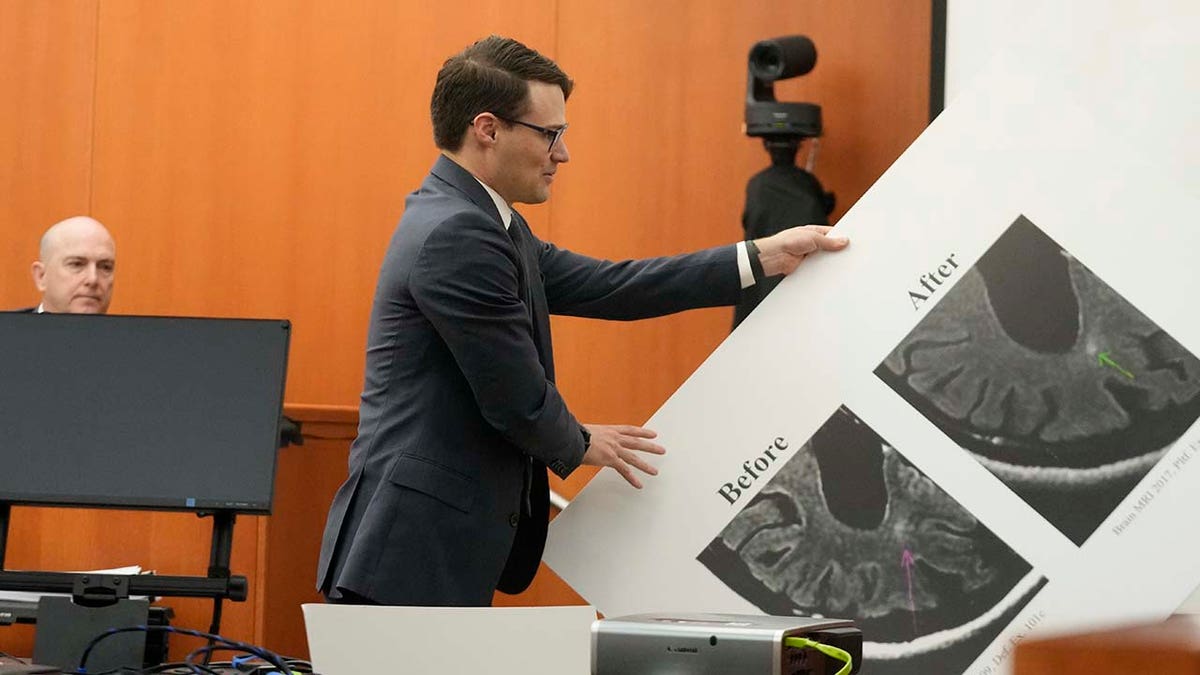 Paltrow attorney James Egan displays a poster showing a brain scan in the courtroom.