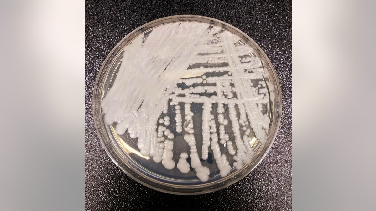 A strain of Candida auris