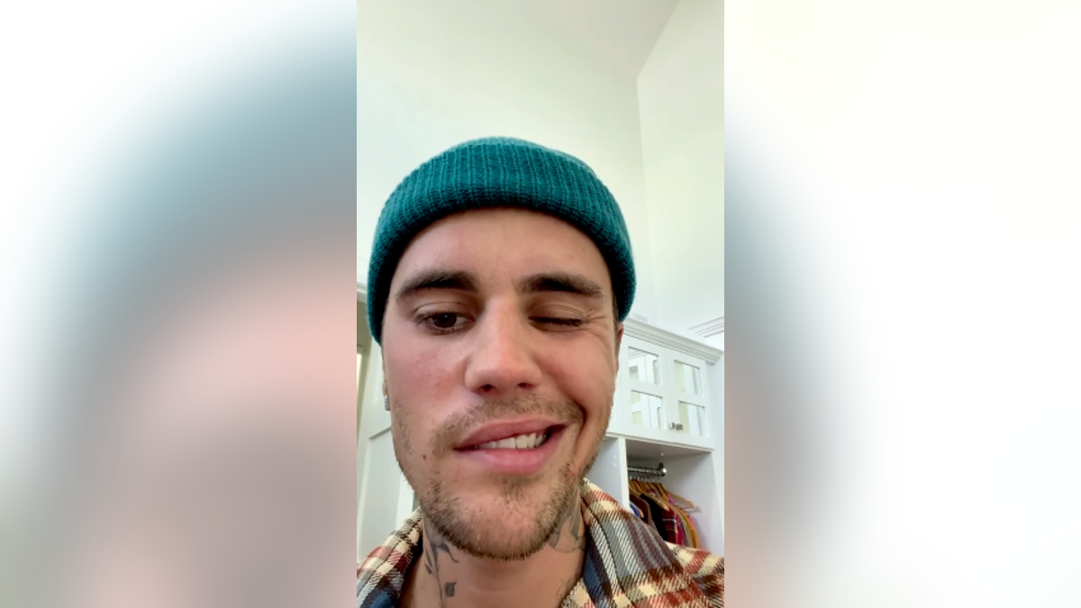 Justin Bieber shows how one side of his face paralyzed
