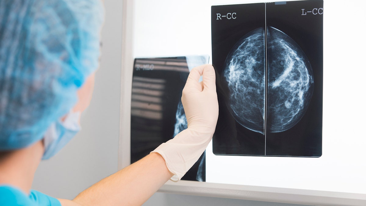 Mammogram X-rays