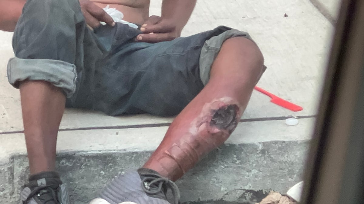 An exposed leg reveals a tranq dope wound