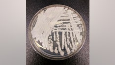 Potentially deadly, drug-resistant fungus spreading rapidly in US