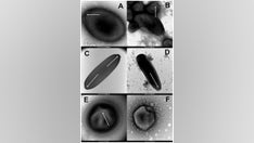 Scientists revive ancient ‘zombie viruses’ from Siberian permafrost that can infect amoeba cells