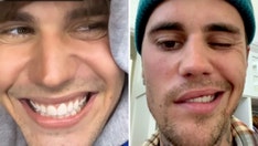 Justin Bieber reveals face mobility following Ramsay Hunt syndrome diagnosis