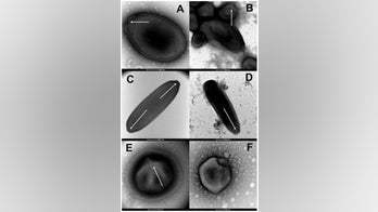 Scientists revive ancient ‘zombie viruses’ from Siberian permafrost that can infect amoeba cells