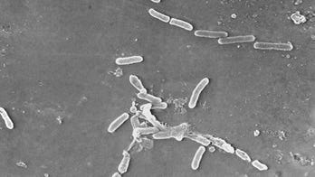 Eyedrops tainted with drug-resistant bacteria linked to 2 more deaths, additional vision loss cases