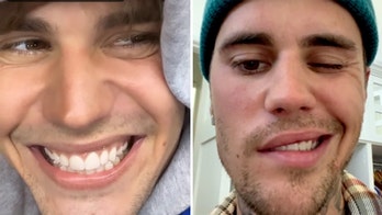 Justin Bieber reveals face mobility following Ramsay Hunt syndrome diagnosis