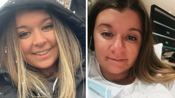 'Pregnancy nose’ has expectant moms going viral on TikTok as medical experts explain the baffling condition