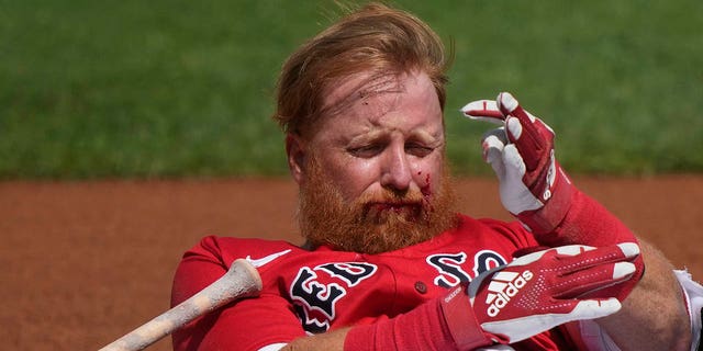 Boston Red Sox Justin Turner reacts after being hit in the face on a pitch by Detroit Tigers starting pitcher Matt Manning during a spring training game in Fort Myers, Florida, on Monday, March 6, 2023.