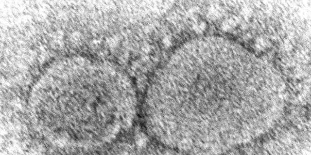 FILE - This 2020 electron microscope image made available by the Centers for Disease Control and Prevention shows SARS-CoV-2 virus particles, which cause COVID-19. 