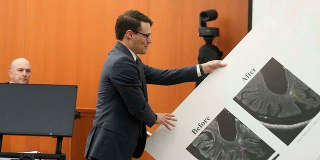 Gwyneth Paltrow attorney James Egan displays a poster showing a brain scan in the courtroom on Wednesday, March 29.