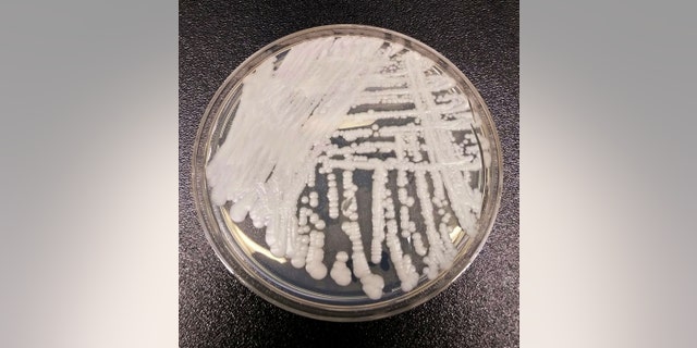 This undated photo made available by the Centers for Disease Control and Prevention shows a strain of Candida auris cultured in a petri dish at a CDC laboratory.