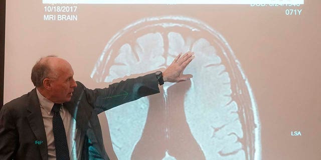 Dr. Wendell Gibby describes an MRI showing the brain of the man suing Gwyneth Paltrow over a 2016 ski collision Wednesday, March 22, 2023, in Park City, Utah.