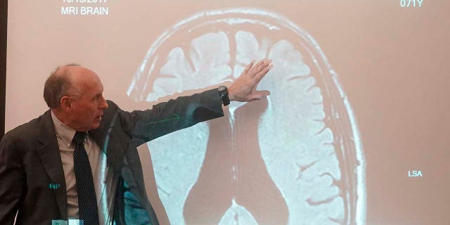 Dr. Wendell Gibby describes an MRI showing the brain of the man suing Gwyneth Paltrow over a 2016 ski collision Wednesday, March 22, 2023, in Park City, Utah.