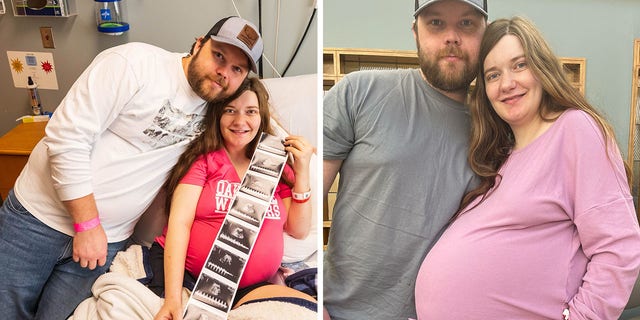 "She had a quintuplet pregnancy with four identical females," said a physician and associate professor at the University of Mississippi Medical Center about Haylee Ladner's very unusual pregnancy. 