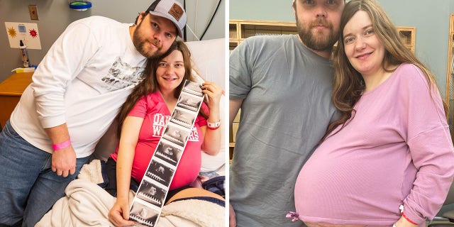 "She had a quintuplet pregnancy with four identical females," said a physician and associate professor at the University of Mississippi Medical Center about Haylee Ladner's very unusual pregnancy.