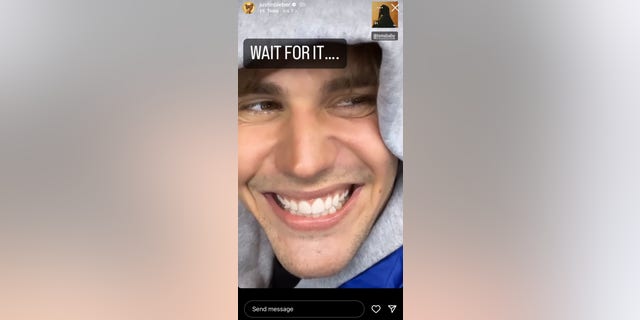 Justin Bieber took to his Instagram to update fans on his health condition by showing mobility in his face.